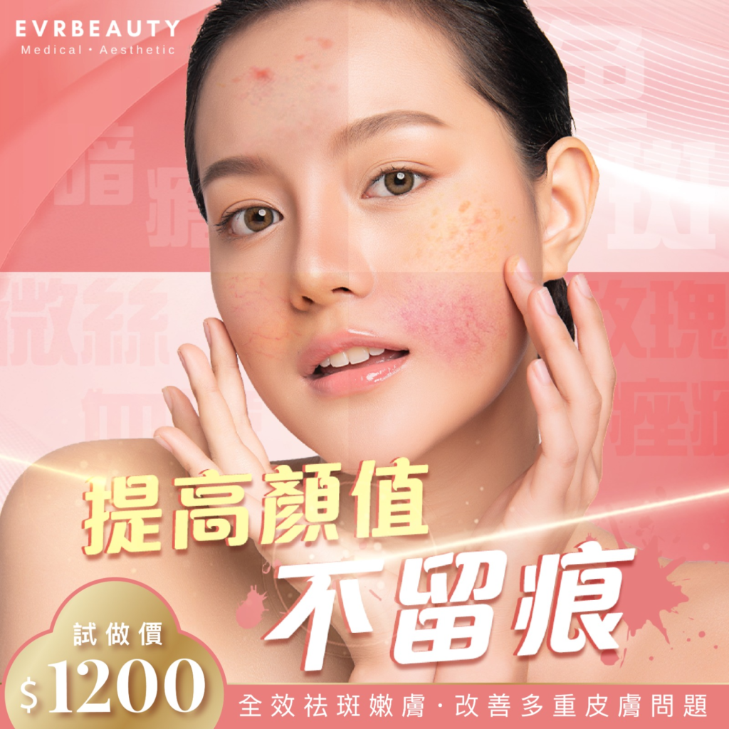 M22 Stellar 脈衝光療程邊間好2023 ︳比較激光醫美品牌EVRbeauty 3大賣點