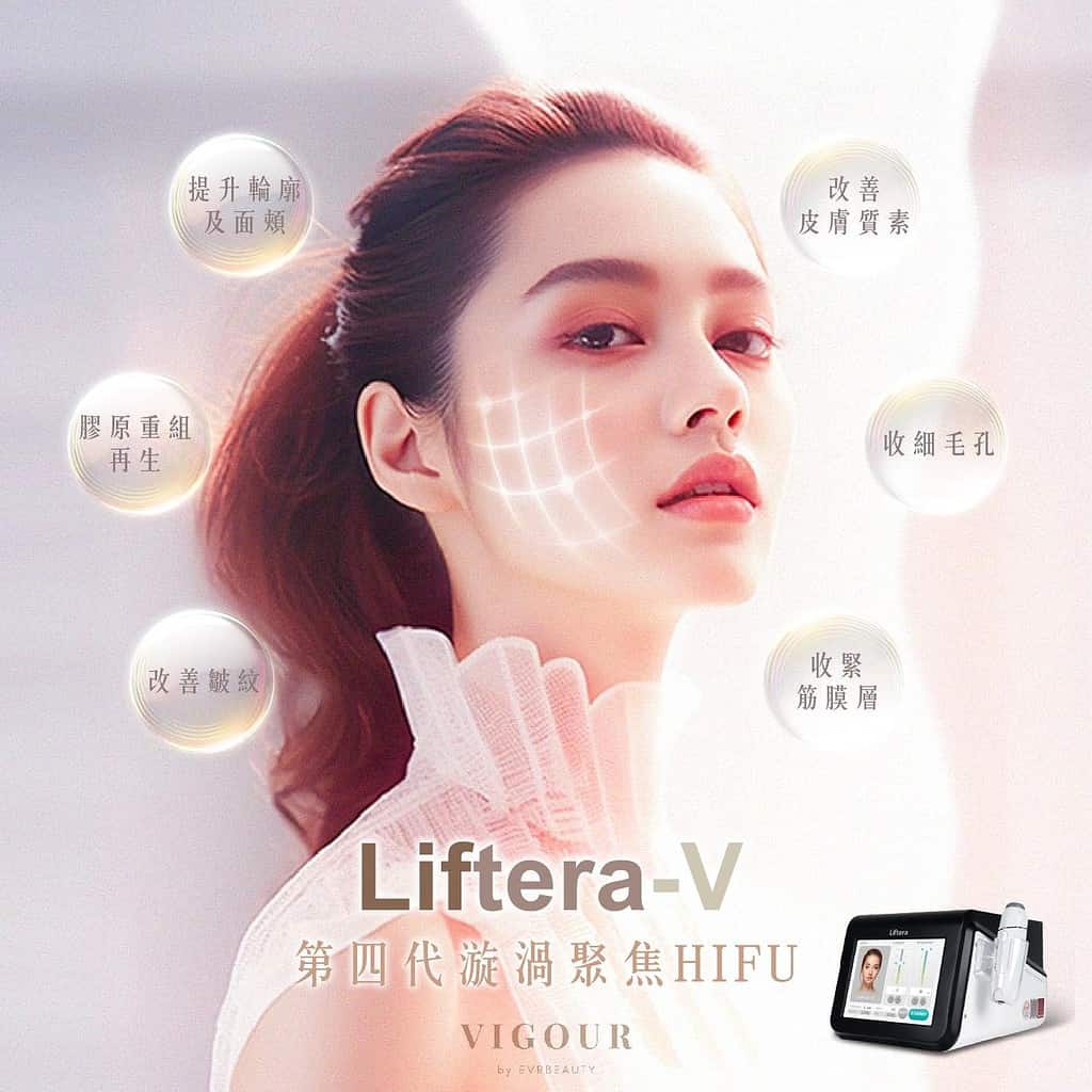 LIFTERA®-V Lift無針埋線